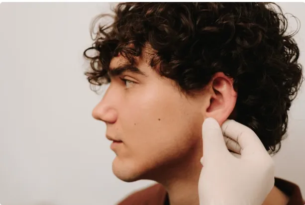 Masculinización facial con ácido hialurónico: Definición y armonía sin cirugía